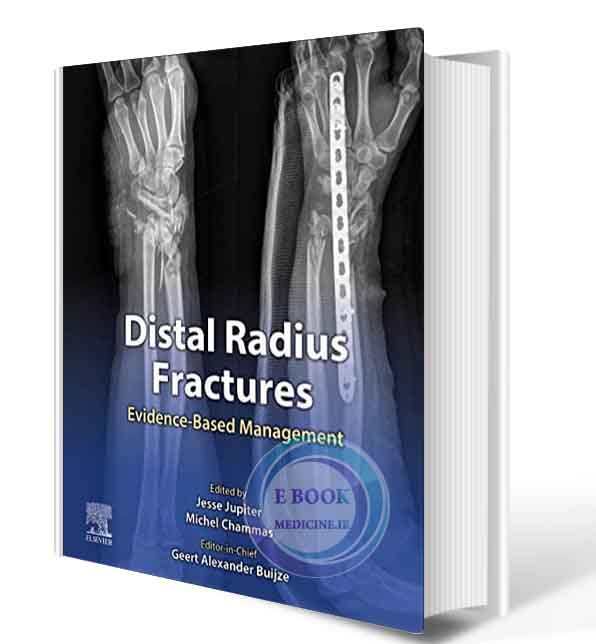 دانلود کتابDistal Radius Fractures: Evidence-Based Management  + video ,1st 2021 (ORIGINAL PDF)